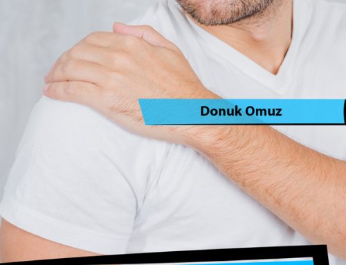 Donuk Omuz (Frozen Shoulder , Omuz Periartriti)